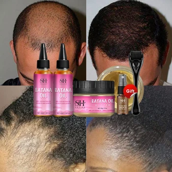 Fast Hair Growth Set Batana oil Traction Alopecia Маска за коса Anti Break Loss Hair Growth Oil Baldness Treatment chebe hair oil